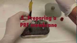 Platelet Rich Fibrin PRF  A short introductory Video [upl. by Adnolrehs]