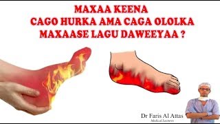 MAXAA KEENA CAGO HURKA AMA CAGA OLOLKA MAXAASE LAGU DAWEEYAA Dr faris [upl. by Ecille]