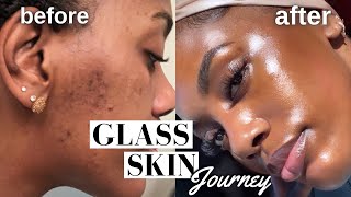 HOW I CLEARED MY HYPERPIGMENTATION ACNE AND DARK SPOTS  GLASS SKIN ROUTINE MUST WATCH [upl. by Preuss356]