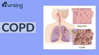 COPD Nursing School Lessons [upl. by Elwira]