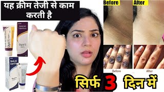 Skin को गोरा कैसे करे  Glycolic acid cream  Glycolic acid cream review  Glyco A  Glycolic acid [upl. by Chapin]