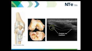 Anatomie en echografie knie deel 1 [upl. by Boswall347]