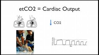 Capnography in Cardiac Arrest [upl. by Bucher685]