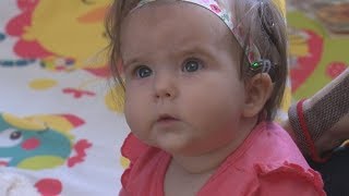 Baby hears for the first time thanks to cochlear implants [upl. by Sybley948]