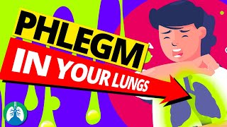 Top 10 Ways to Get Rid of Constant Mucus and Phlegm in Your Throat [upl. by Anivram655]