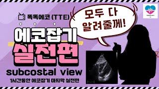 심장초음파 실전 Subcostal 4chamber view 잡기 echocardiography 심장초음파 TTE sonography rdcs cardiology [upl. by Otrebire664]