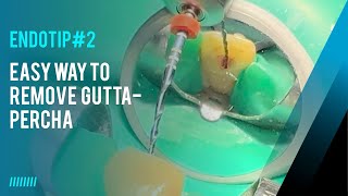 Endotip 2  easy way to remove gutta percha in Endodontic retreatments [upl. by Novick484]