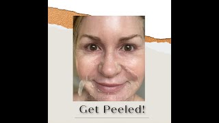 ZO Skin Health Chemical Peel Before During After Results [upl. by Lienad948]