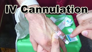 How to Insert IV Cannula  IV Cannulation Technique  Branula  Intravenous Catheter [upl. by Nimzay]