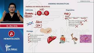 HEMATOLOGÍA  Anemias macrocíticas Anemias no megaloblásticas [upl. by Drucie348]