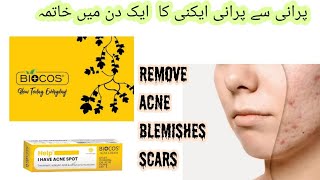 Biocos Acne Cream  Anti Acne Cream  Remove blemishes  Scars in First Application [upl. by Netnert]