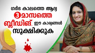 ഗർഭ കാലത്തെ ആദ്യ 3 മാസത്തെ ബ്ലീഡിങ് ഈ കാര്യങ്ങൾ സൂക്ഷിക്കുക  Pregnancy Bleeding Malayalam [upl. by Aceber]