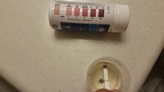 Keto test strips PART i [upl. by Hiltner]