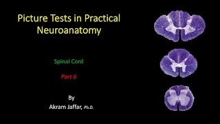 Picture Test in Neuroanatomy Spinal Cord 6 [upl. by Garett329]