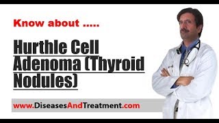 Hurthle Cell Adenoma Thyroid Nodules  Causes Diagnosis Symptoms Treatment [upl. by Annaigroeg]