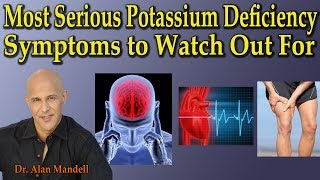 3 Most Serious Potassium Deficiency Symptoms to Watch Out For  Dr Alan Mandell DC [upl. by Sanfo]