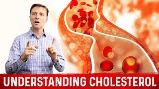 How to Read and Understand Your Cholesterol Levels [upl. by Richardo268]