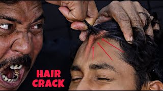 Unlimited Hair Cracking by Asim Barber  Head massage amp Neck Cracking  Loud Spine Cracking  ASMR [upl. by Onida]