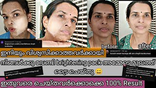 ഇനിയും വിശ്വസിക്കാത്തകാർക്കു വേണ്ടിയാണ് ഈ video  Skin whitening Face Pack At Home viral face pack [upl. by Alenoel310]