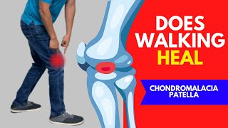 Is Walking Actually Helpful To Heal Chondromalacia Patella [upl. by Teiluj]