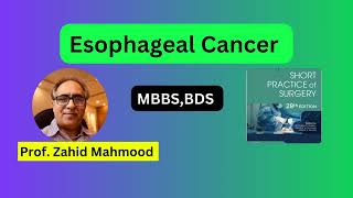 Esophageal Cancer MBBS BDS [upl. by Waylin]