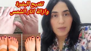 9وصفات طبيعية سهلة من مطبخك لازالة اتار الشمس وتفتيح بشرة الوجه العنق واليدين [upl. by Hanej]