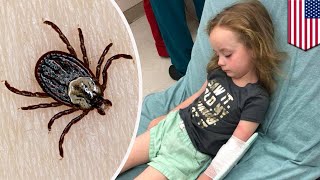 Tick paralysis Girl temporarily paralyzed from tick bite  TomoNews [upl. by Eniawed]