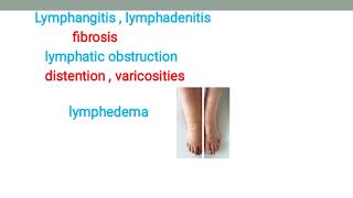 Wuchereria bancrofti Lymphatic filariasis Elephantiasis داء الفيل [upl. by Jamison]