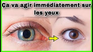 Comment obtenir des yeux clairs et illuminés  Conseils de blanchiment des yeux [upl. by Sherrer]