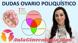 DUDAS SÍNDROME de OVARIO POLIQUÍSTICO Síntomas y tratamiento  Ginecología y Obstetricia [upl. by Us]