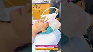 Best Micro needling Face PRP Treatment  The Skin Clinic By Alkhaleej [upl. by Monroy850]