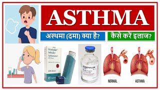 ASTHMA  MEDICINES  अस्थमा दमा क्या है कैसे करें इलाज MEDICINE USE TO TREAT ASTHMA [upl. by Alvar]