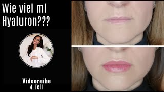 4 Teil  Hyaluron Pen Lippen  Wie viel ml Hyaluron habtisbeauty [upl. by Aihsinat949]