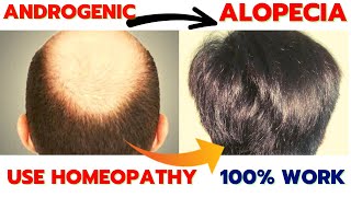 Homeopathy Medicine For Androgenic Alopecia  Homeopathy Medicine For Hair Fall And Regrowth [upl. by Iniffit576]