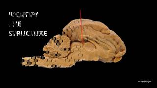 sheep brain dissection structures review for anatomy practical exam [upl. by Huntingdon]