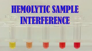 HEMOLYTIC SAMPLE INTERFERENCE [upl. by Wennerholn46]