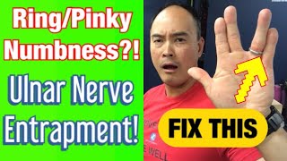 Ulnar Nerve Entrapment 4 Easy StretchesExercises For Relief  Dr Wil amp Dr K [upl. by Agna76]