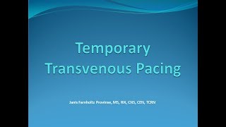 Temporary Tranvenous Pacing [upl. by Oirottiv890]