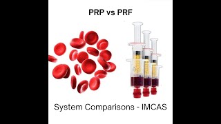 PRPPRF System Comparisons  IMCAS [upl. by Baryram]