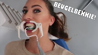 ESRA KRIJGT EEN BEUGEL  VLOG 44  FAMILIE VLOGGERS [upl. by Nickelsen]