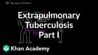 Extrapulmonary TB part 1  Infectious diseases  NCLEXRN  Khan Academy [upl. by Anat]