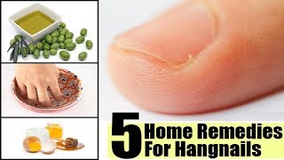 5 Effective Home Remedies to Get Rid of Hangnails  By Top 5 [upl. by Adala426]