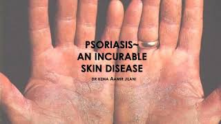 PSORIASIS A SHORT OVERVIEW  DERMATOLOGY  CLINICAL MEDICINE  MEDICAL REVISION GUIDE [upl. by Ahsenrad]