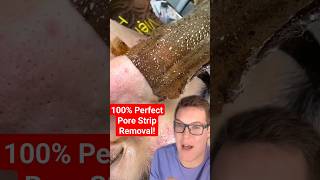 😍 Perfect PORE STRIP REMOVAL shorts [upl. by Apfel]