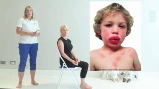 Top Tips for Anaphylaxis  First Aid [upl. by Sacha140]