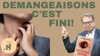 Astuces santé  traiter la démangeaison [upl. by Oremar]