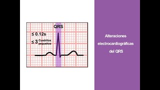 Video 4 Alteraciones en el ECG del QRS [upl. by Tnarud]