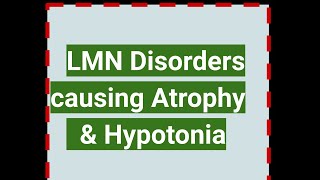 LOWER MOTOR Disorders causing Atrophy amp Hypotonia [upl. by Hoeg]