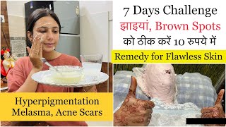 7 Days Challenge for Hyperpigmentation Dark Spots Melasma Flawless Glowing Skin  Dr Upasana Vohra [upl. by Anrahs871]