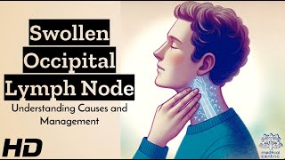 Swollen Occipital Lymph Node Whats Behind It [upl. by Zitella]